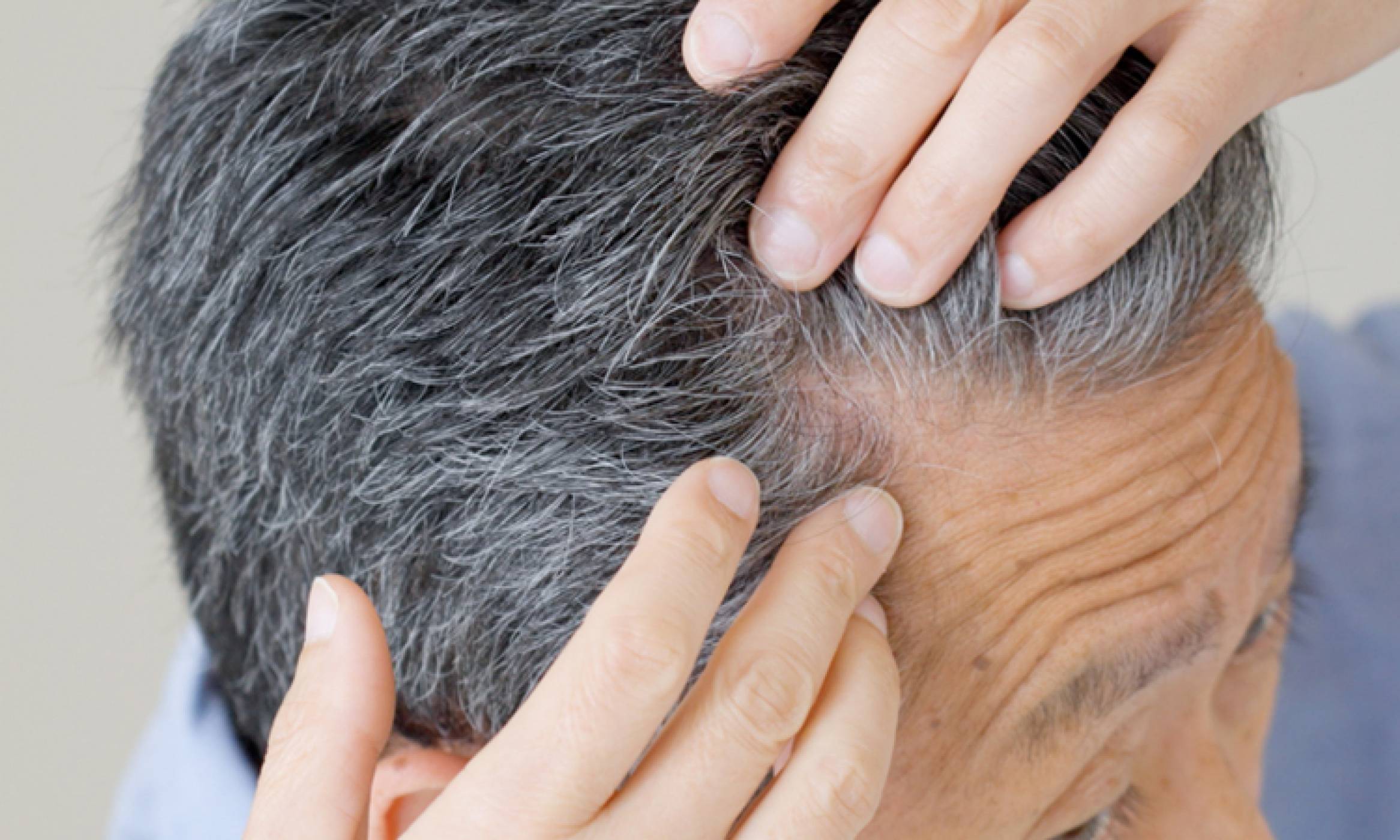 Close-up of a man's scalp as he parts his grey hair with his fingers, pointing at the roots of his hair.