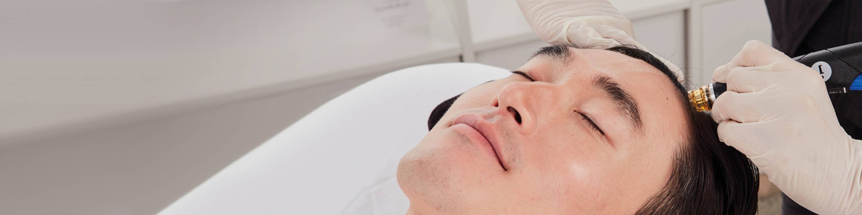 Close shot of a relaxed man with eyes closed undergoing HydraFacial Keravive treatment on his scalp to help regrow hair