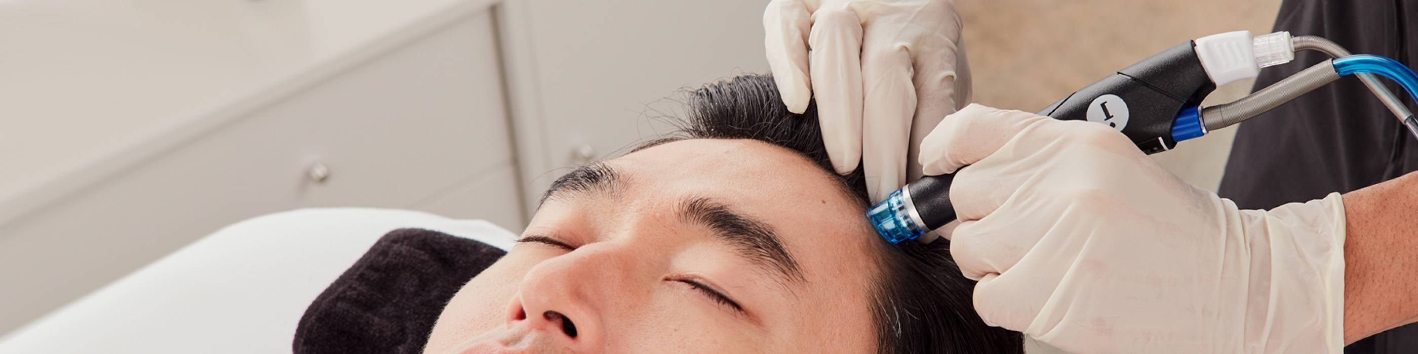Close-up of relaxed man with eyes closed undergoing HydraFacial Keravive treatment for hair loss to help regrow thicker hair.