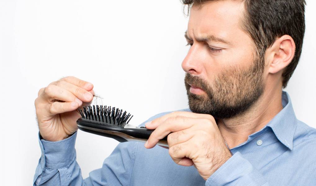 What You Must Know About COVID-19 & Hair Loss.
