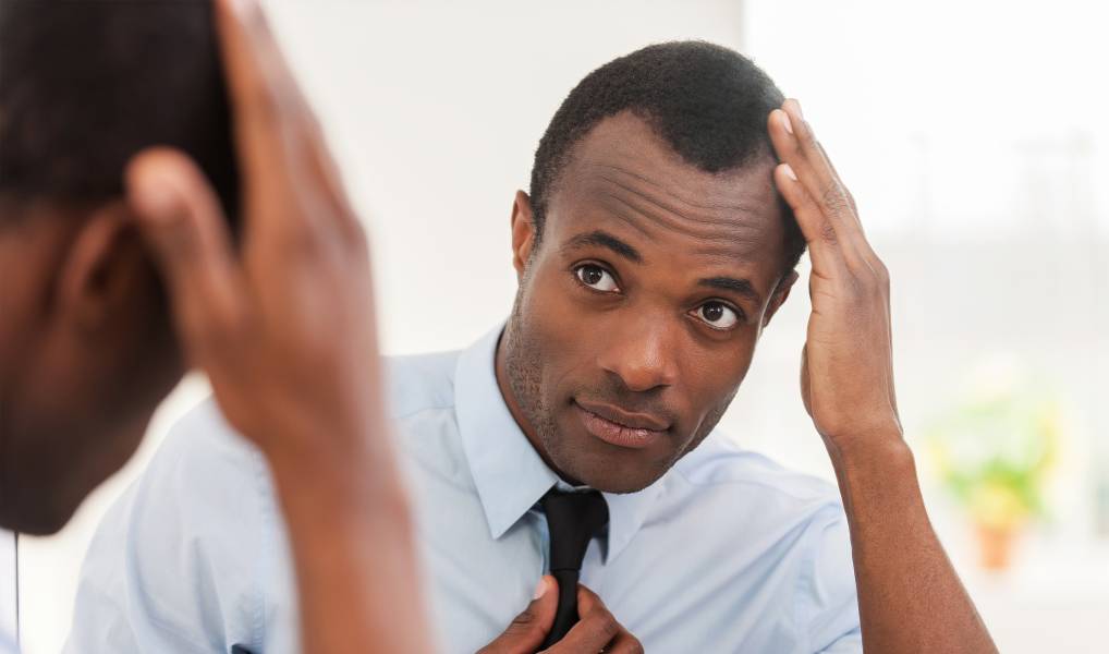 Hair Restoration for African American & Caribbean Patients