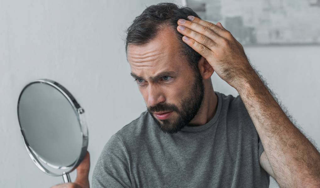 DHT & Hair Loss: What Really Causes It—and What Helps