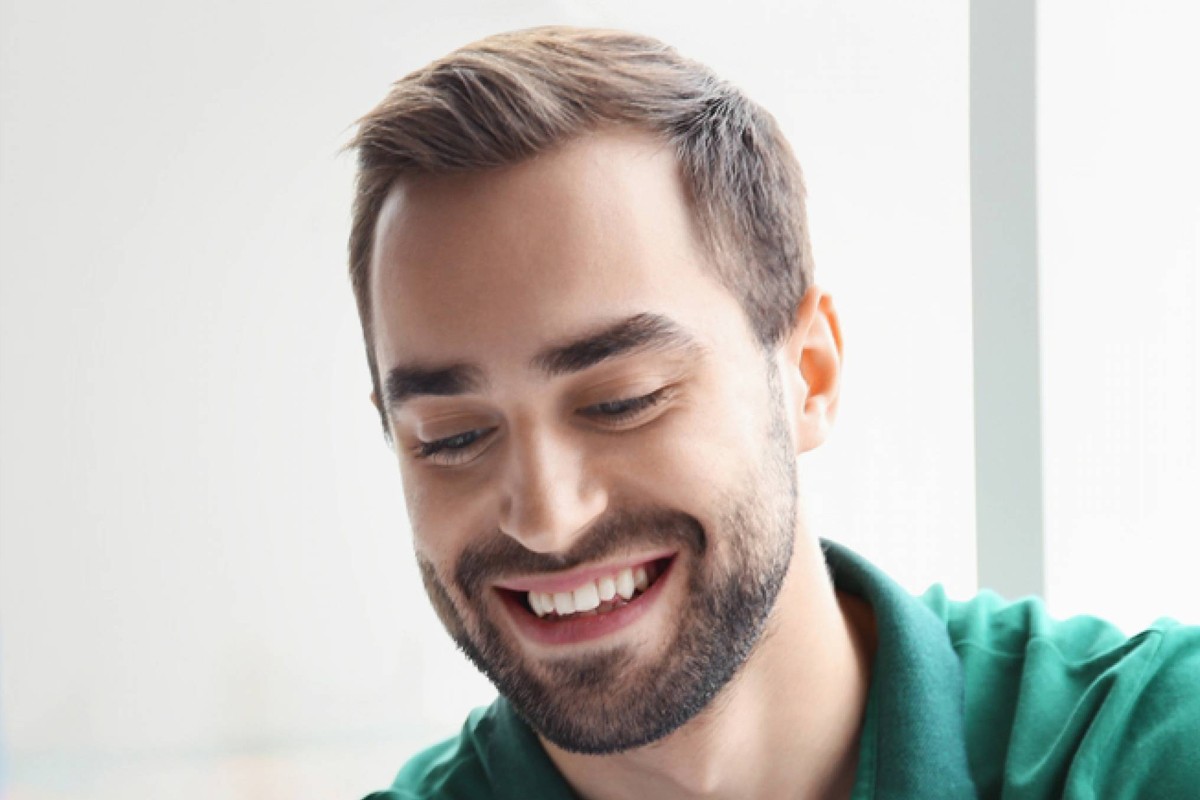 Man with restored natural hairline after hair transplant for receding