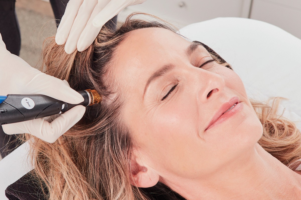 Woman with hair thinning receiving HydraFacial Keravive scalp treatment to improve hair growth and scalp health