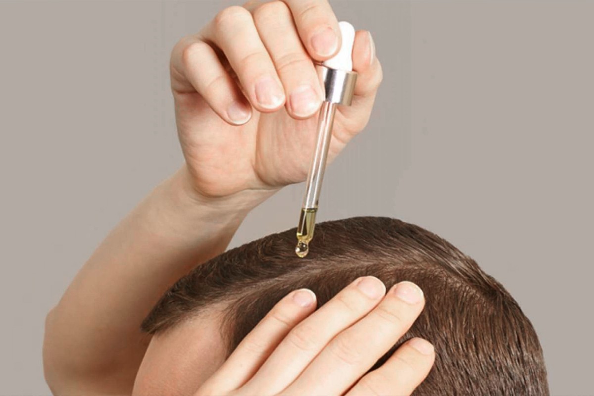Applying topical hair growth serum to scalp as part of hair loss treatment products