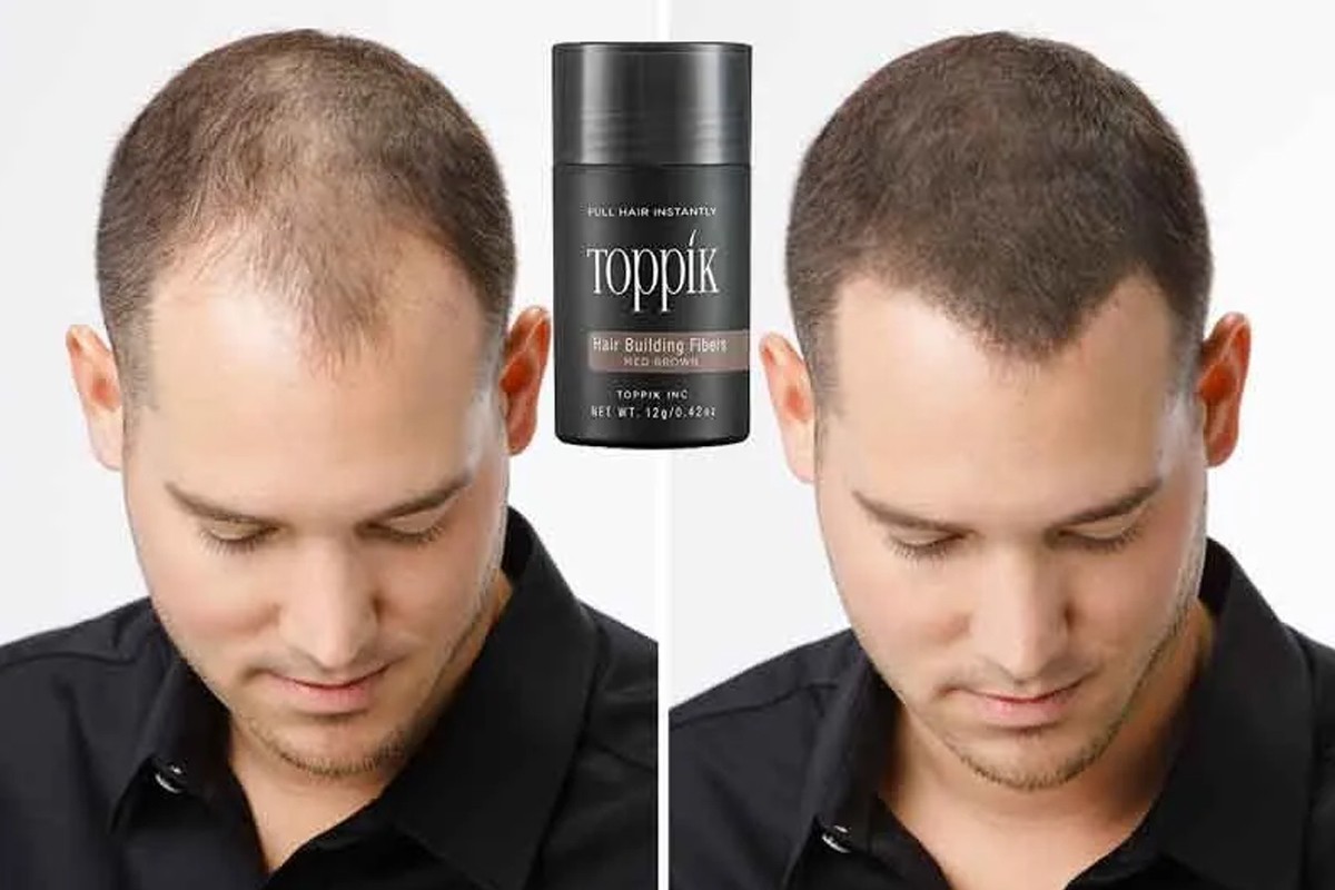 Before-and-after results of Toppik Hair Building Fibers for thinning hair, with product container shown.